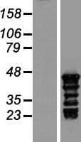 TSPY3 Protein (Over-Expression Lysate Myc-DDK (Flag))