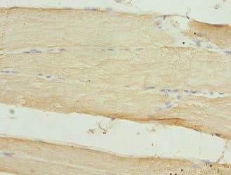 Polyclonal Rabbit anti-Human CLK1 / CLK Antibody (IHC, WB)