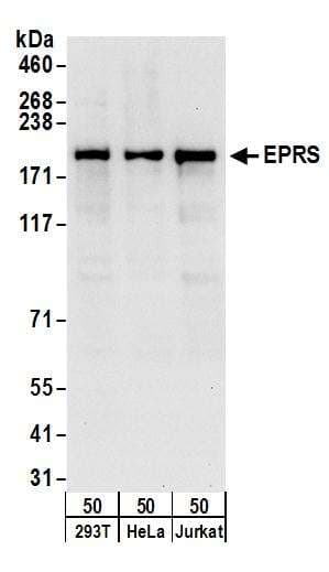 RPL11 / Ribosomal Protein L11 Antibody (aa128-178)