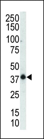 MAPK12 / ERK6 / SAPK3 Antibody (aa336-367)