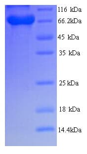Human BRAP2 Protein (Recombinant His)