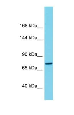 Polyclonal Rabbit anti-Human C1orf112 Antibody (aa755-804, WB)