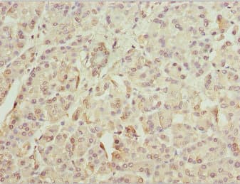 ZFYVE1 / DFCP1 Antibody
