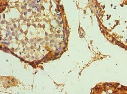 GATA3 Antibody (aa1-260)
