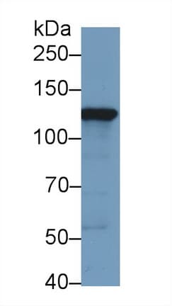 HK2 / Hexokinase 2 Antibody (aa619-917)
