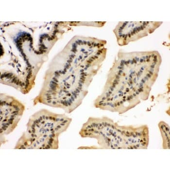 Polyclonal Rabbit anti-Human EIF6 Antibody (aa66-210, IHC, WB)
