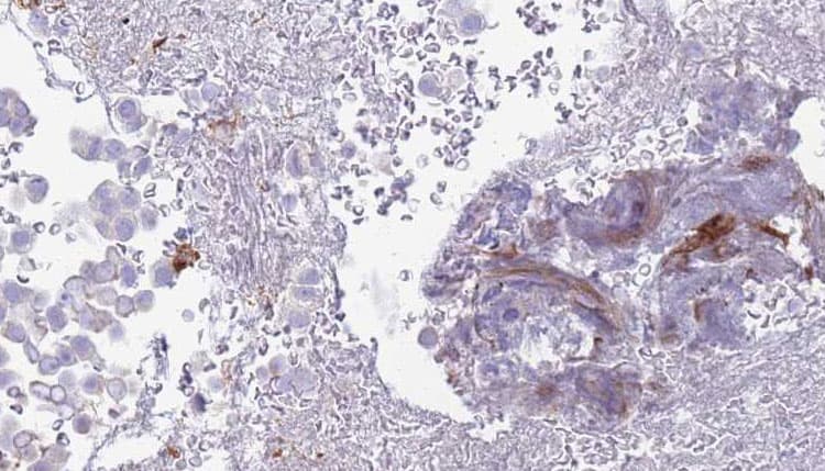 Polyclonal Rabbit anti-Human ADGRE5 / CD97 Antibody (IHC, WB)