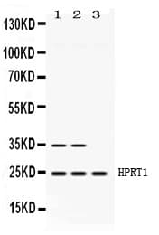 HPRT1 / HPRT Antibody