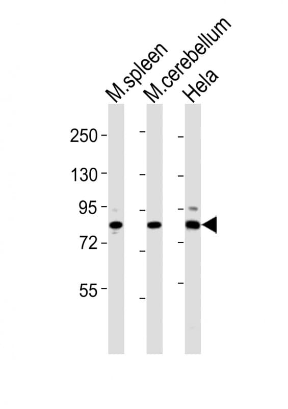 SUZ12 Antibody (aa381-395)