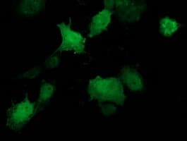 Monoclonal Mouse anti-Human STAT5A Antibody (clone OTI9A5, IHC, IF, WB)