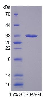Human CA13 / Carbonic Anhydrase XIII Protein (Recombinant)