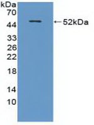 CRAT Antibody (aa1-430, APC)
