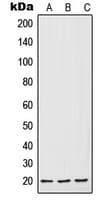 IL7 Antibody (Internal)