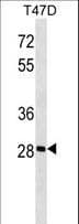 Polyclonal Rabbit anti-Human GK5 Antibody (aa1-30, WB)