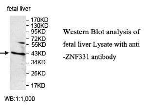 ZNF331 Antibody (aa75-352)