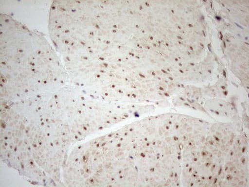 WTAP Antibody (aa2-106, clone OTI12G7, Carrier-free)