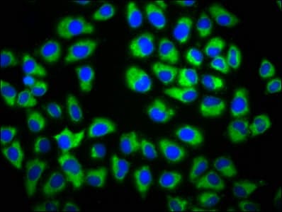 Polyclonal Rabbit anti-Human GAS1 Antibody (IHC, WB)
