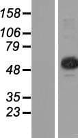 TRM6 / TRMT6 Protein (Over-Expression Lysate Myc-DDK (Flag))