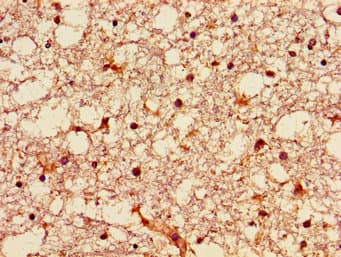 GNPAT / DHAP-AT Antibody