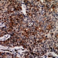 Polyclonal Rabbit anti-Human FASTKD3 Antibody (IHC, WB)