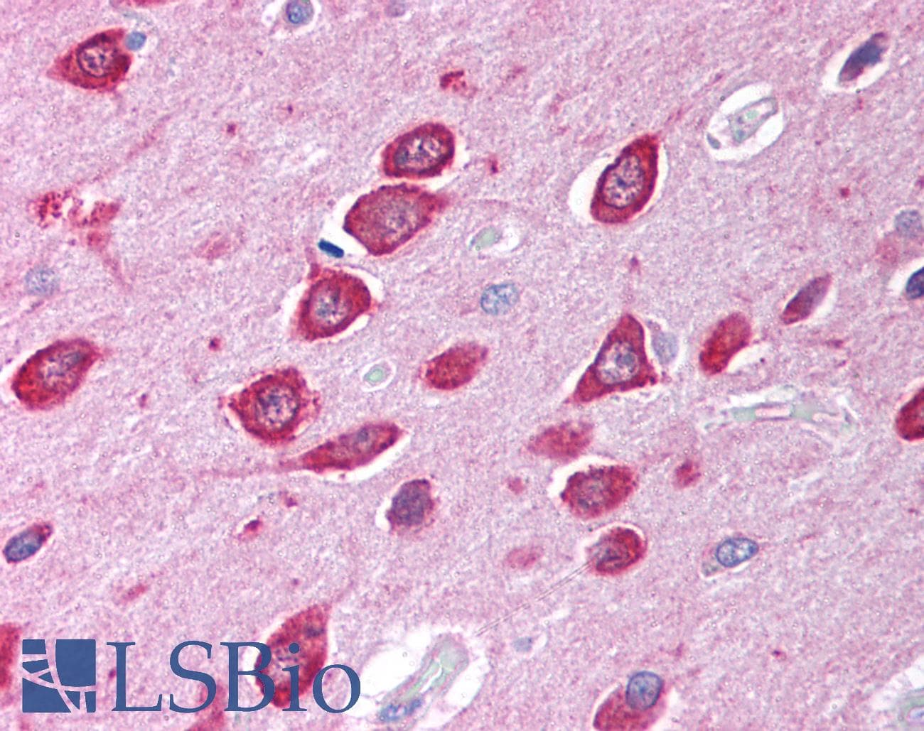 STIM2 Antibody