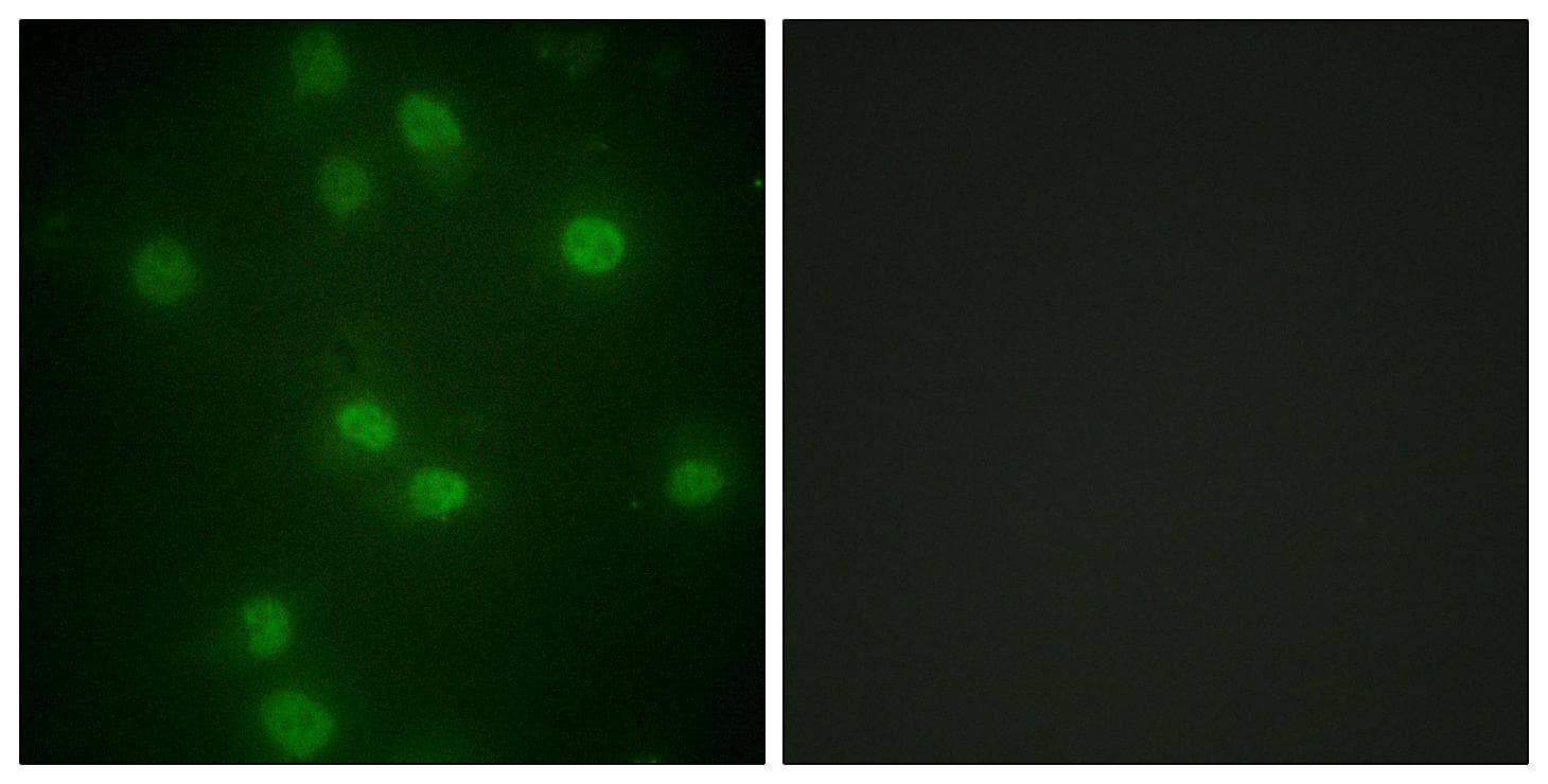 RB1 / Retinoblastoma / RB Antibody (phospho-Ser811)