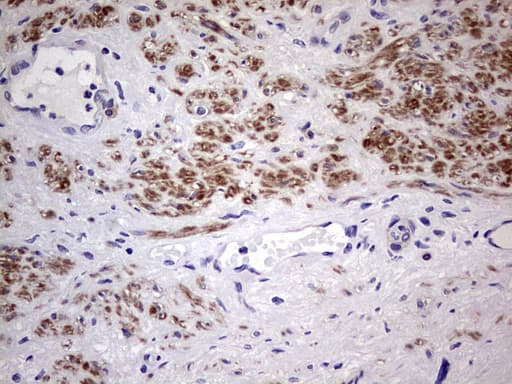 CFLAR / FLIP Antibody (aa1-272, clone OTI2H8)