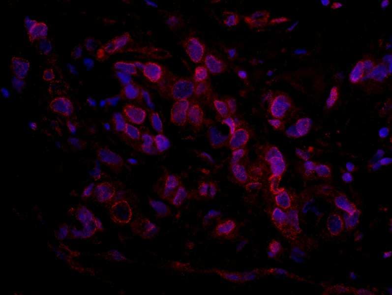 ARID4B Antibody (aa125-175)