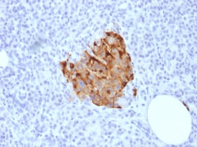 Recombinant Monoclonal Rabbit anti-Human CHGA / Chromogranin A Antibody (clone CHGA/1773R, Azide-free,Carrier-free, IHC)