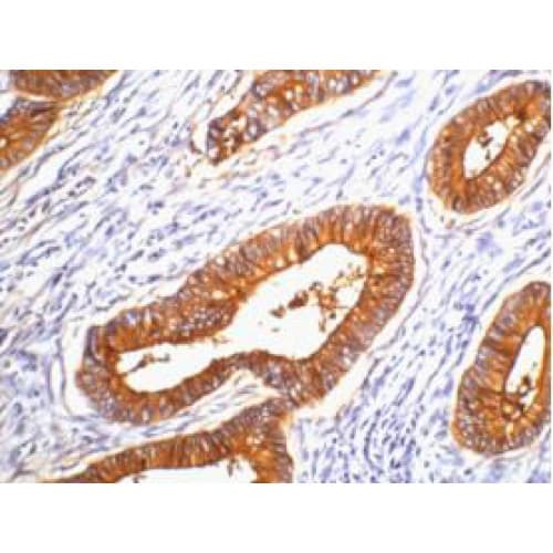 Monoclonal Mouse anti-Human CEACAM5 / CD66e Antibody (clone 10E1, IHC)