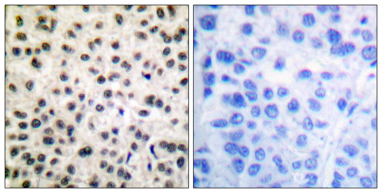 MEF2A / MEF2 Antibody (phospho-Ser408)