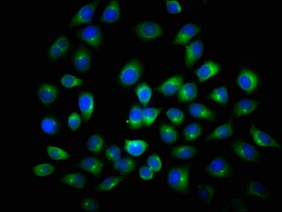 Polyclonal Rabbit anti-Human ANAPC2 / APC2 Antibody (IHC)