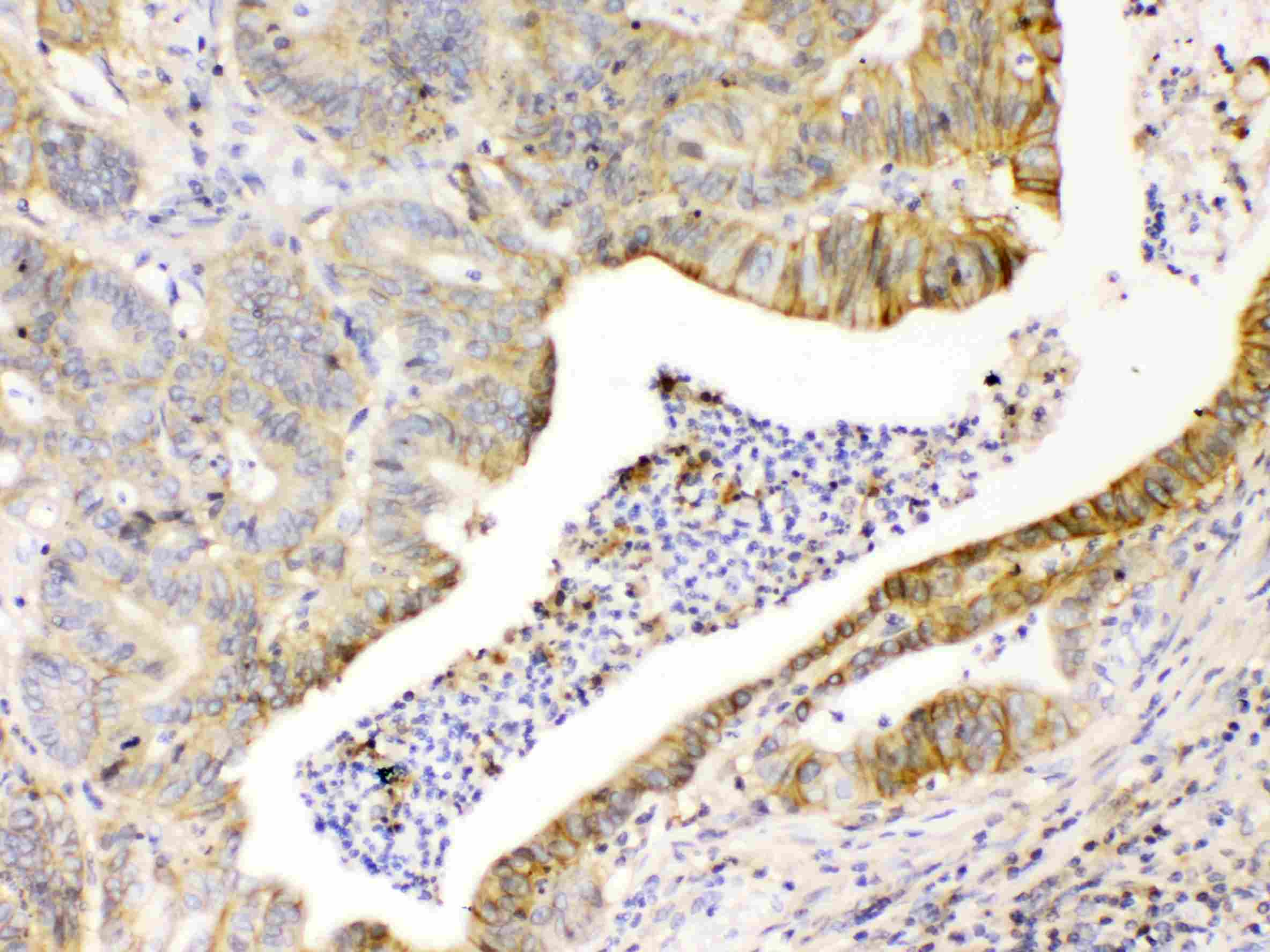 Basigin / Emmprin / CD147 Antibody