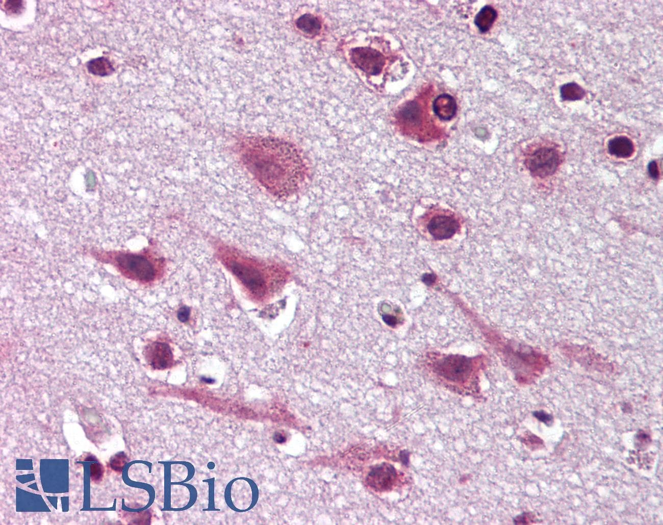 IHC-plus™ MAPK9 / JNK2 Antibody (N-Terminus)