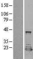 Human PTS Protein (Over-Expression Lysate Myc-DDK (Flag))