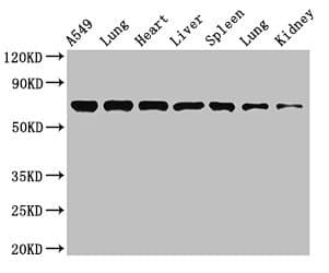 RPA70 / RPA1 Antibody
