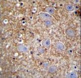 Polyclonal Rabbit anti-Human XKR4 Antibody (aa570-598, IHC, IF, WB)