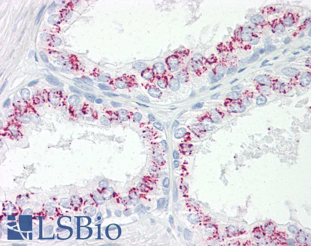 Polyclonal Rabbit anti-Human CPEB3 Antibody (aa324-373, IHC, WB)