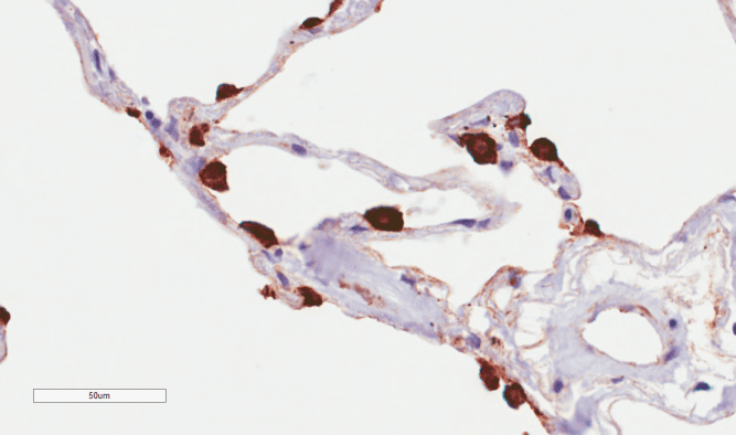 Recombinant Monoclonal Rabbit anti-Human EMA / MUC1 Antibody (clone HMFG2, MUC1, IHC)
