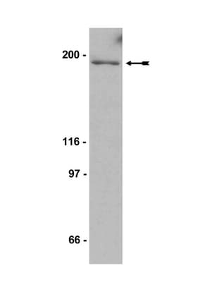 IHC-plus™ FLT1 / VEGFR1 Antibody (aa1251-1338)