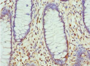 IHC-plus™ Polyclonal Rabbit anti-Human LIMS1 / PINCH Antibody (IHC, IF, WB)