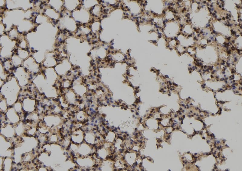 UBE2M / UBC12 Antibody