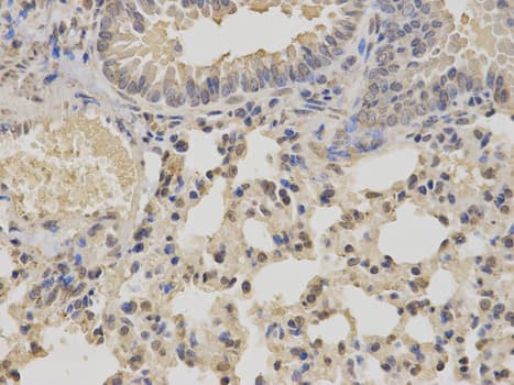 IKBKE / IKKI / IKKE Antibody