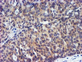 TIMP2 Antibody (clone OTI2G7)