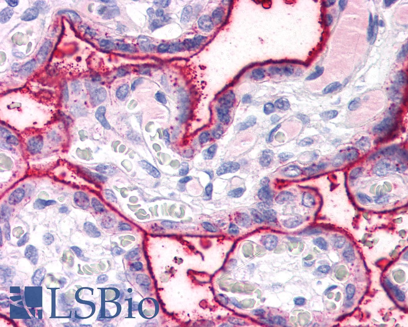 IHC-plus™ Polyclonal Rabbit anti-Human SURF4 Antibody (N-Terminus, IHC)