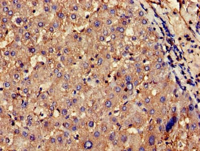 CNKSR2 Antibody (aa650-800)