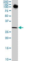 Monoclonal Mouse anti-Human RPRD1A Antibody (clone 1B8, WB)