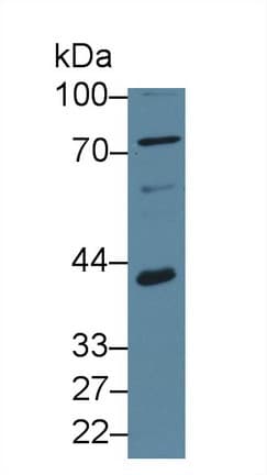 SERPINB4 / SCCA1+2 Antibody (aa211-390)