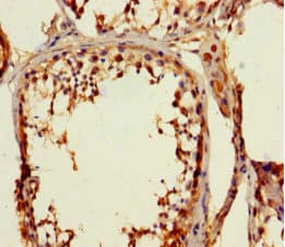 Polyclonal Rabbit anti-Human ZNF77 Antibody