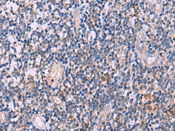 IL4R / CD124 Antibody
